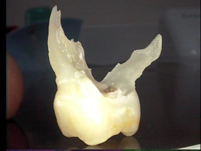 002 gdi7j2 - Eugenol