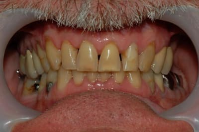 002 obduzd - Eugenol