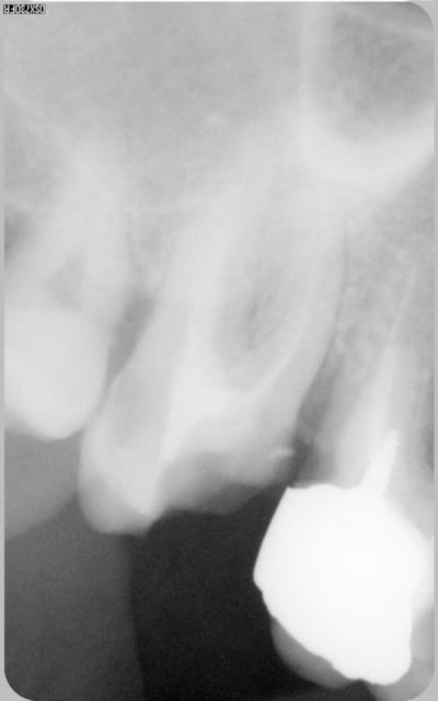 004 lfnebn - Eugenol