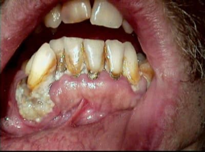 004 nordu4 - Eugenol