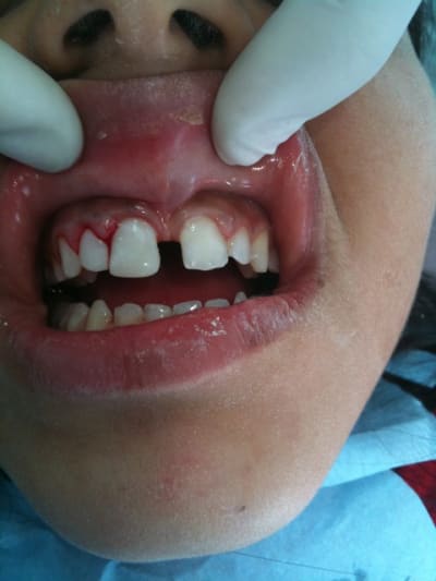 004 vblgmi - Eugenol