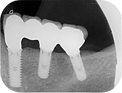 00577 x 2011 01 10 17 58 21 4 bdd8x5 - Eugenol