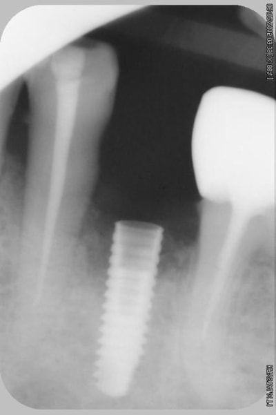 005copier qvbpna - Eugenol