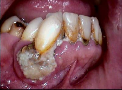 005 askupo - Eugenol