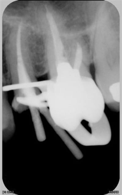 006 udehtu - Eugenol