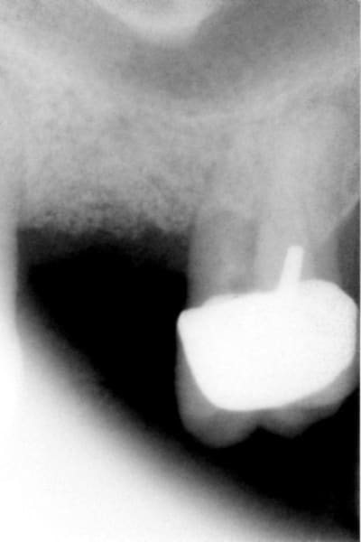 007 hiiuik - Eugenol