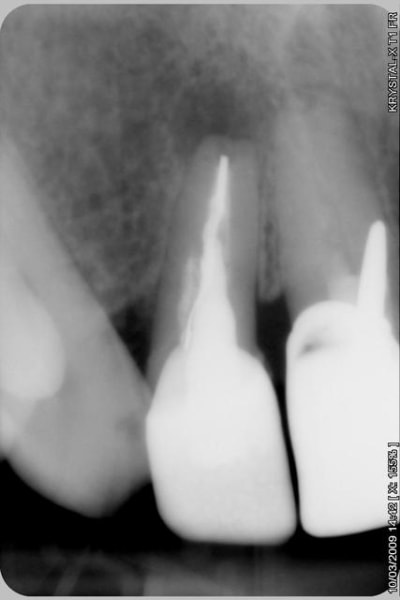 007 ypwim6 - Eugenol