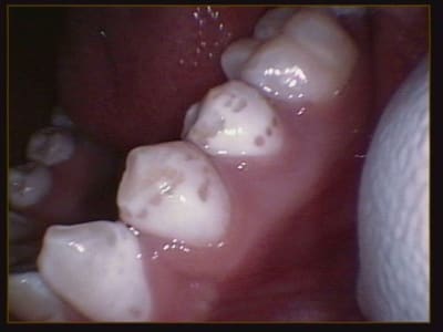 008 hz3cxl - Eugenol