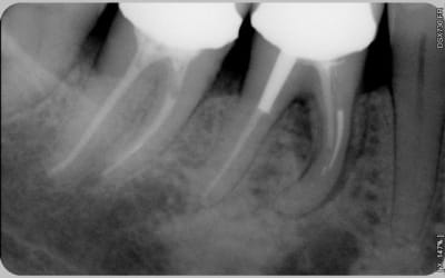 008 iihgsq - Eugenol