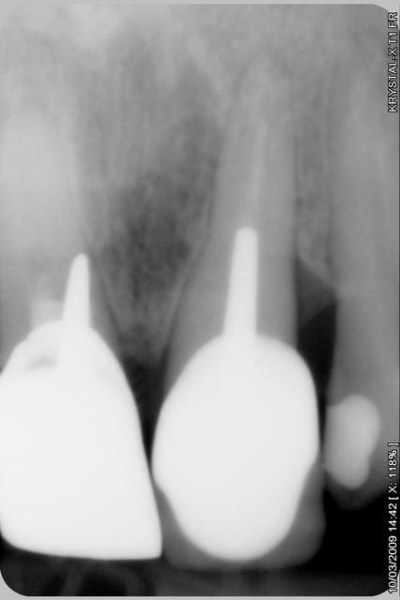 008 p5tzjo - Eugenol