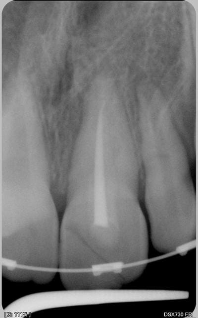 008 rlodrw - Eugenol