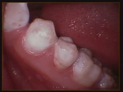 012 koihwf - Eugenol