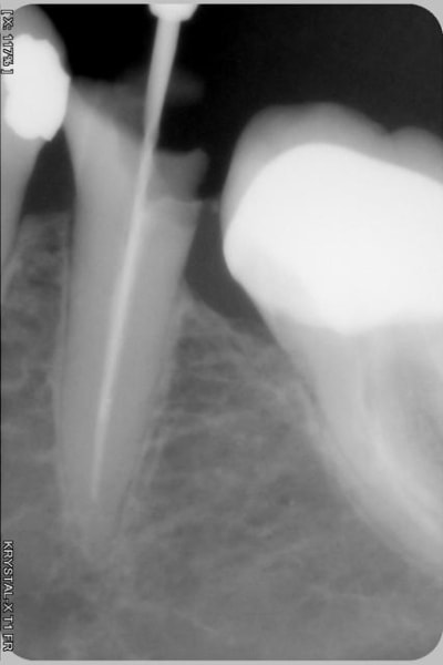 016 kildmj - Eugenol