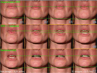 02 dsd 6ms xpygwb - Eugenol