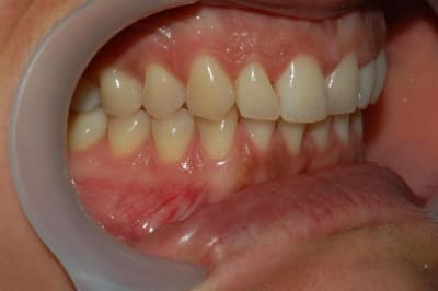 034 vg9h9a - Eugenol