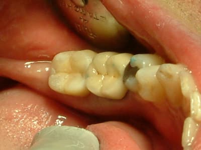 04051514 grkvu2 - Eugenol