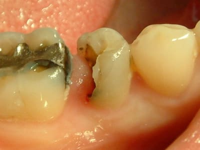 04090713 cfbstt - Eugenol