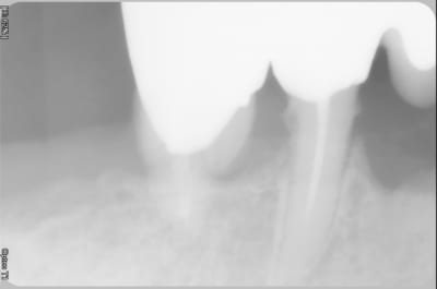 04890010 jmf3so - Eugenol