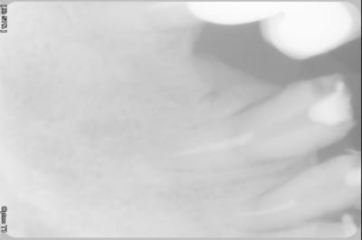 04890014 fg0vuv - Eugenol