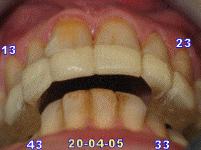 050420 rmda jxevsb - Eugenol