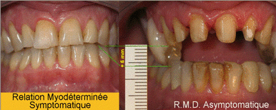 050710 15amartyrs yrhaka - Eugenol