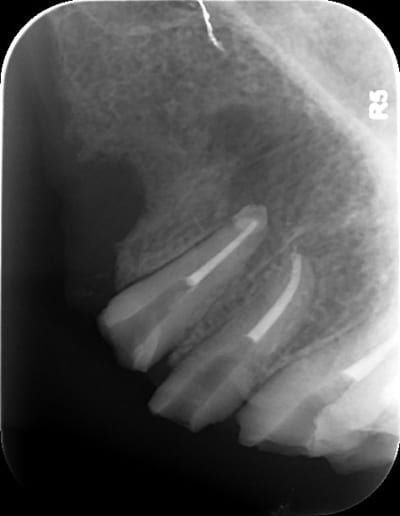 07112014 iusvkt - Eugenol
