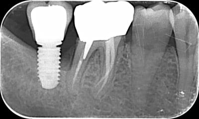 0m9sk9om5qohtixu0ri1s02xitbj - Eugenol