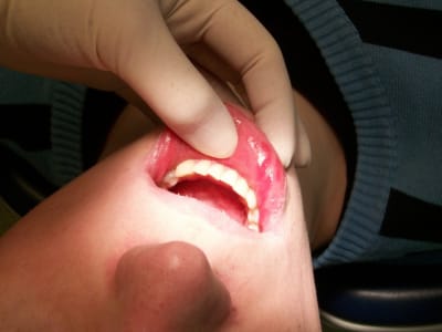 100 0450 oreear - Eugenol