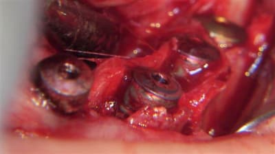 100 0642 ukk9op - Eugenol