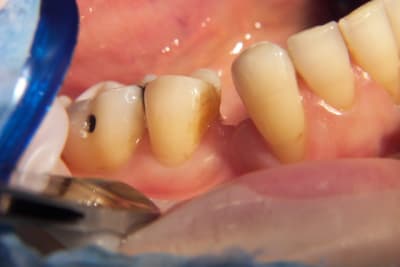 100 1098 bvtgmr - Eugenol