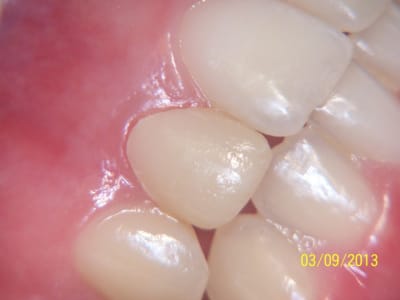 100 1320 pgromp - Eugenol