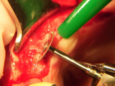 100 5339 zhpn79 - Eugenol