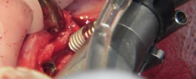 100 5393 aemtos - Eugenol