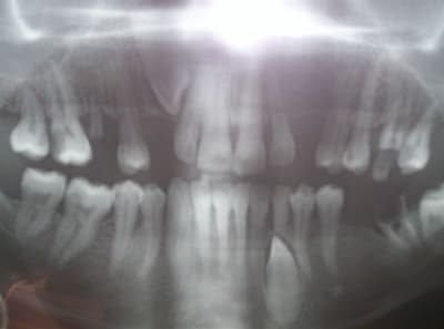 100 5894 wrkrcf - Eugenol