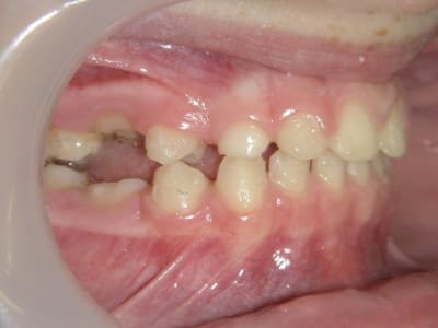 10705 06 09 15 08940 tfexfp - Eugenol