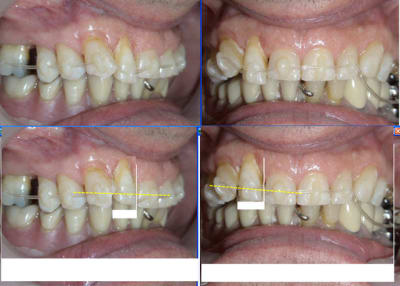 10877 12g otneme - Eugenol