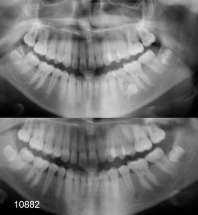 10882 2pano wn0qas - Eugenol