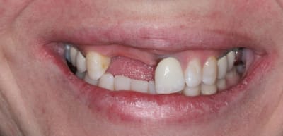 11 12 3 alq4lh - Eugenol