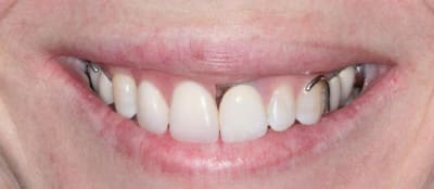 11 12 lr6mjd - Eugenol