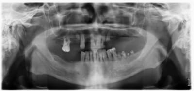 123 s91s15 - Eugenol