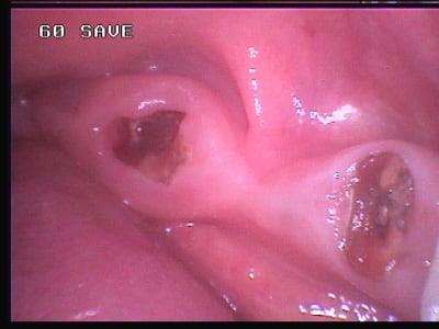 124 athxpu - Eugenol