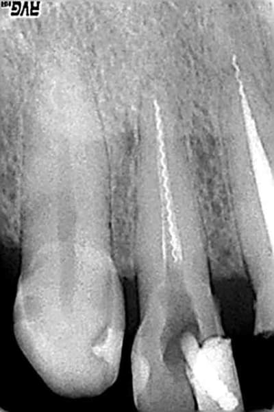 12 qudirz - Eugenol