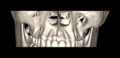 13d w92pjv - Eugenol