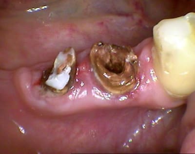 147 a3nh5n - Eugenol