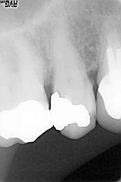 15 16 bj2blw - Eugenol