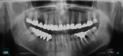 1984 1988 wibdom - Eugenol