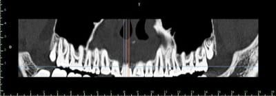 1panoramique vujuk2 - Eugenol