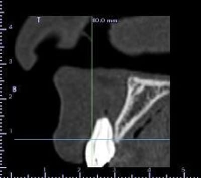 1s quence 2 tr6bnm - Eugenol