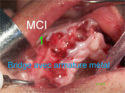1 2 3 mci 001 fisuwq - Eugenol