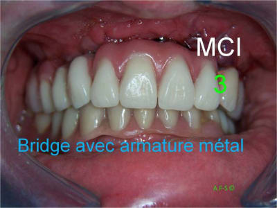 1 2 3 mci 006 ufbves - Eugenol